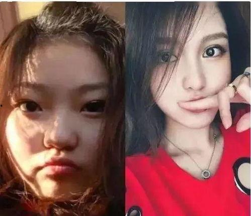 整容爆料视频,视频爆料揭露美丽背后的代价  第2张